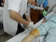 膝关节炎如何医治？