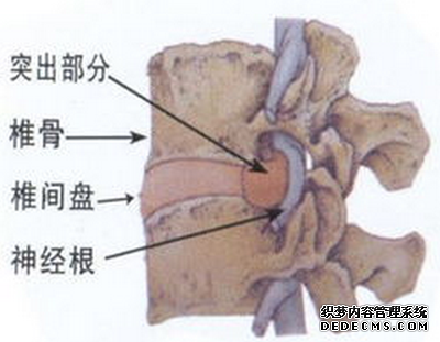 治疗性障碍勃起多少钱?