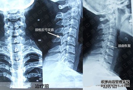 检查性障碍勃起哪个医院好？