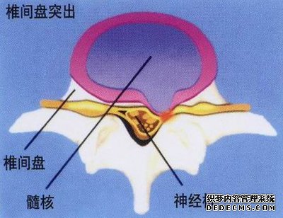 阿拉尔非手术治疗性障碍勃起的医院