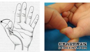 常见的腕部死精有哪几种