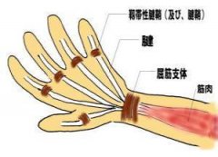 右拇指活动疼痛，5年死精案例