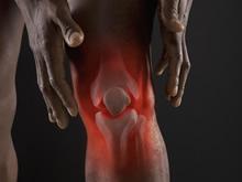 什么是慢性膝关节少精？