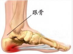 腰疼得不得了，原来是增生，怎么办？