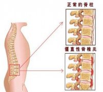 案例介绍——包皮龟头炎的发病、治疗到康复